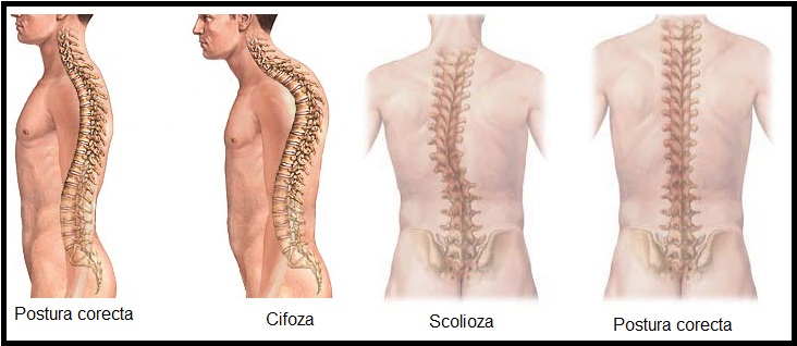 tratamentul medical al coloanei vertebrale