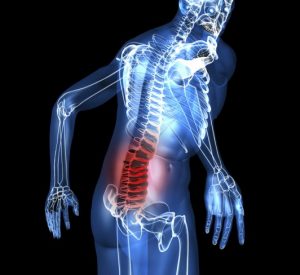 dureri de spate din spate durerile de spate ameliorează inflamația