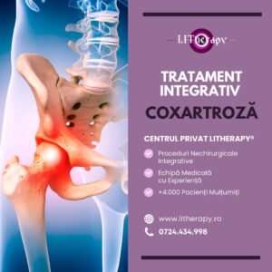 Tratament Coxartroza